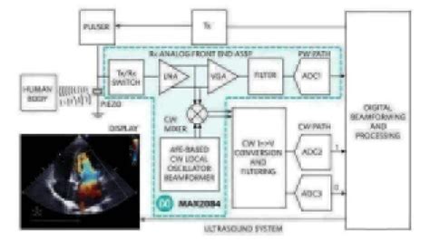 advanced ultrasound systems|Advances in Ultrasound Imaging Architecture: The Future Is Now.